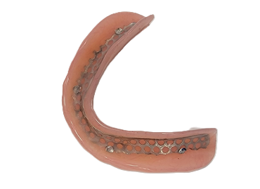 Renfort métallique